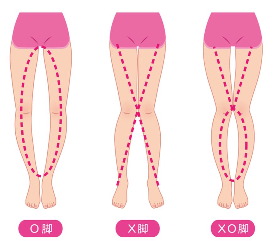 【必見】O脚の改善法を知って、美脚を目指そう!簡単ストレッチ大公開